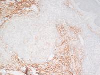 CD10 IHC CMZL