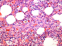 Periarteriolar localization of granulocytic precursors normal BMBx