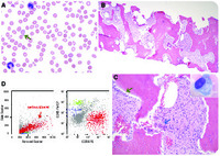 renal osteodystrophy histology