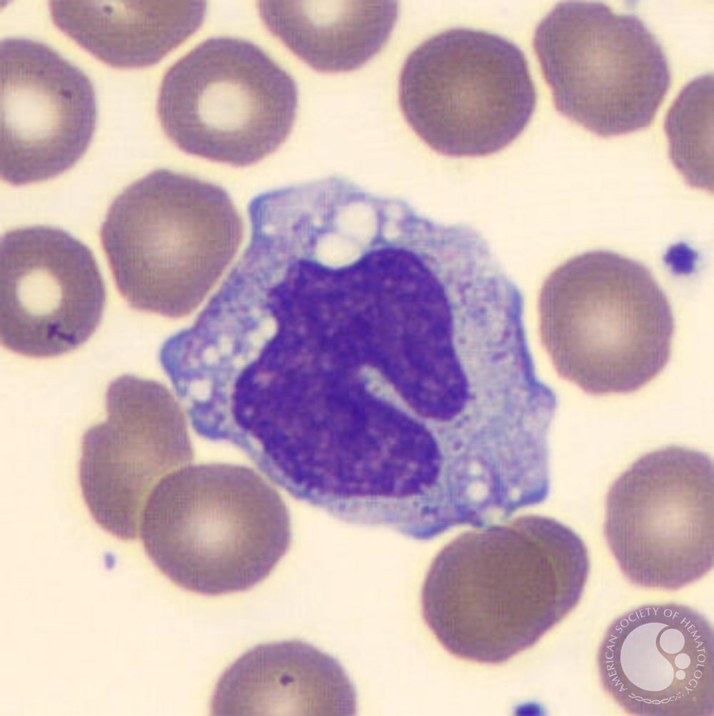 Monocyte