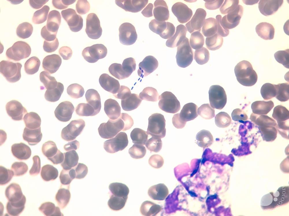 free bacteria on peripheral blood smear
