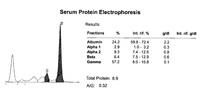 A man with low back pain and anemia 3