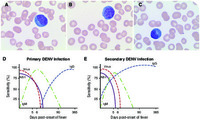 atypical lymphocyte ebv