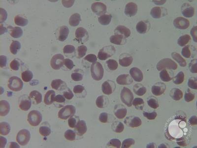 Erythrocyte Hemighosts Cells