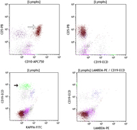 CD10+ T-cells in AITL