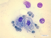 Blood Cell Structure Elodea Labeled Leaf Cells Structures Microscope