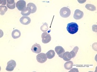 Leishmania bodies