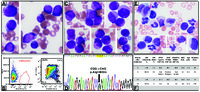 Targeted therapy–induced differentiation of acute myeloid leukemia blasts