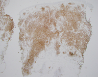 CD3 stain