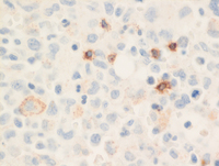 CD2 IHC