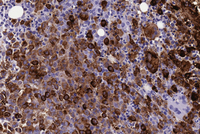 Tryptase IHC