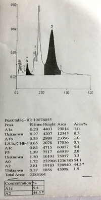 HPLC shows a peak of more than 40% in HbA2 retention window.