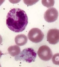 Giant platelets 4