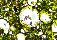 Histoplasmosis - GMS stain