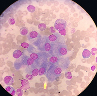 Osteoblasts in BM 2