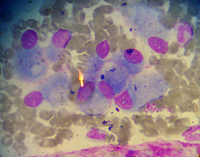 Osteoblasts in BM 3