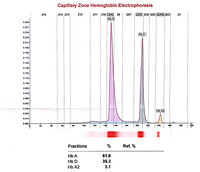 Haemoglobin D