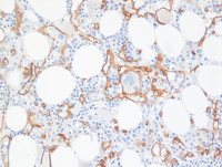Intrasinusoidal hematopoiesis
