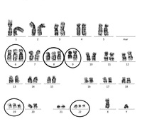 Extra Philadelphia chromosomal karyotype with gain of chromosome 6, 8, and 19 in CML-Myeloid BC
