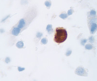 Parvovirus IHC