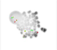 Interphase nuclei and Metaphase (inverted DAPI) showing t(9;22)(q34;q11.2)