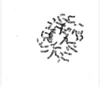 Image showing metaphase, processed metaphase and Karyotype 2