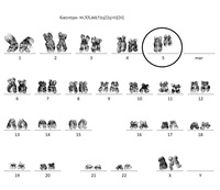 5q Syndrome- deletion 5q as a sole abnormality