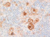CHLNS CD30