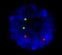 APL-cytogenetics