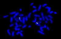 APL-cytogenetics