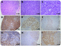 Unusual location of a follicular lymphoma with features of pediatric-type follicular lymphoma