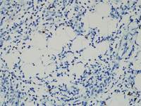 HVLPD-CD8
