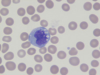 normal monocytes