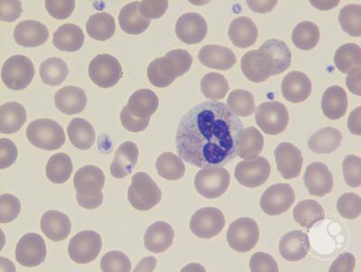 Neutrophil