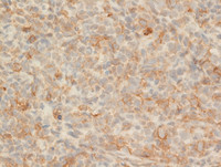 IHC CD4