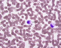 Peripheral smear  showing cocci in pairs within the cytoplasm of a monocyte.