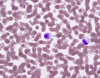 diplococci