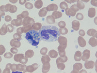 Histoplasmosis in Neutrophils 2