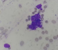 Presence of LE cells in Bone Marrow