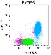 Chronic Lymphoproliferative Disorder of NK Cells - Flow Plots