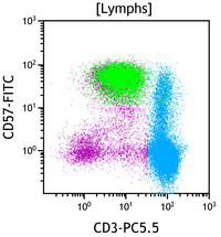 Chronic Lymphoproliferative Disorder of NK Cells - Flow Plots