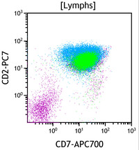 Chronic Lymphoproliferative Disorder of NK Cells - Flow Plots