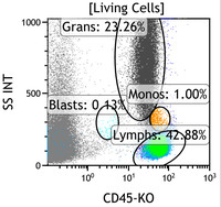 Chronic Lymphoproliferative Disorder of NK Cells - Flow Plots