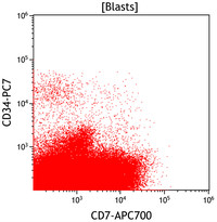 Mixed Phenotype Acute Leukemia, B/myeloid: Flow Plots CD7vsCD34