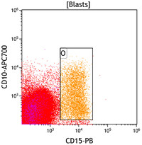 Mixed Phenotype Acute Leukemia, B/myeloid: Flow Plots CD15vsCD10