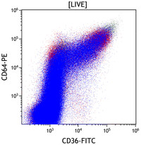 Mixed Phenotype Acute Leukemia, B/myeloid: Flow Plots CD36vsCD64