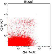 Mixed Phenotype Acute Leukemia, B/myeloid: Flow Plots CD117vsCD34