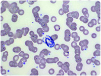 Fungal spore contamination mimicking parasitic infection