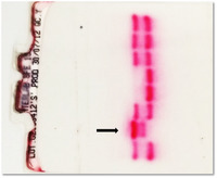 hemoglobin electrophoresis cellulose acetate