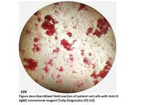 Diagnosing D Variant Serologically in the Laboratory